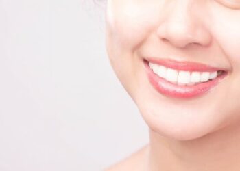 Transforming Smiles with Dental Veneers and Smile Makeovers: A Complete Guide